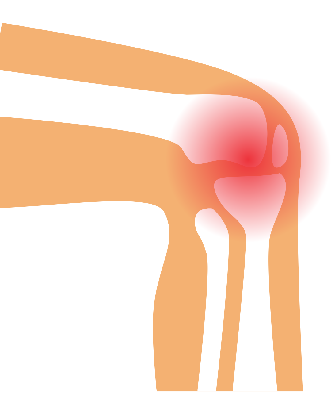 <p><strong>Joint Protection</strong></p>